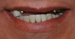 case study 1