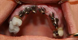 case study 1