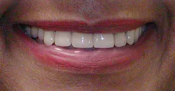 case study 2