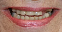 case study 4