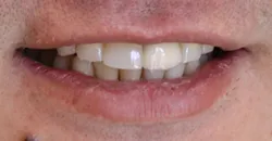case study 9